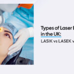 Types of Laser Eye Surgery | Dr MM eye care